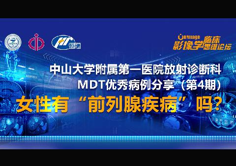 【直播预告】中山大学附属第一医院放射诊断科MDT优秀病例分享（第4期）诚邀您参加